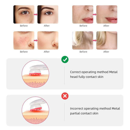 Radiofrecuencia facial portátil