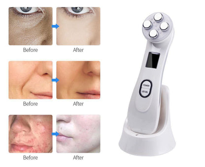Radiofrecuencia facial portátil