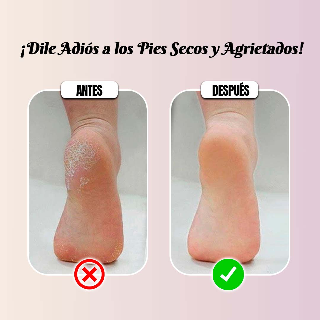 Medias silicona para pies agrietados